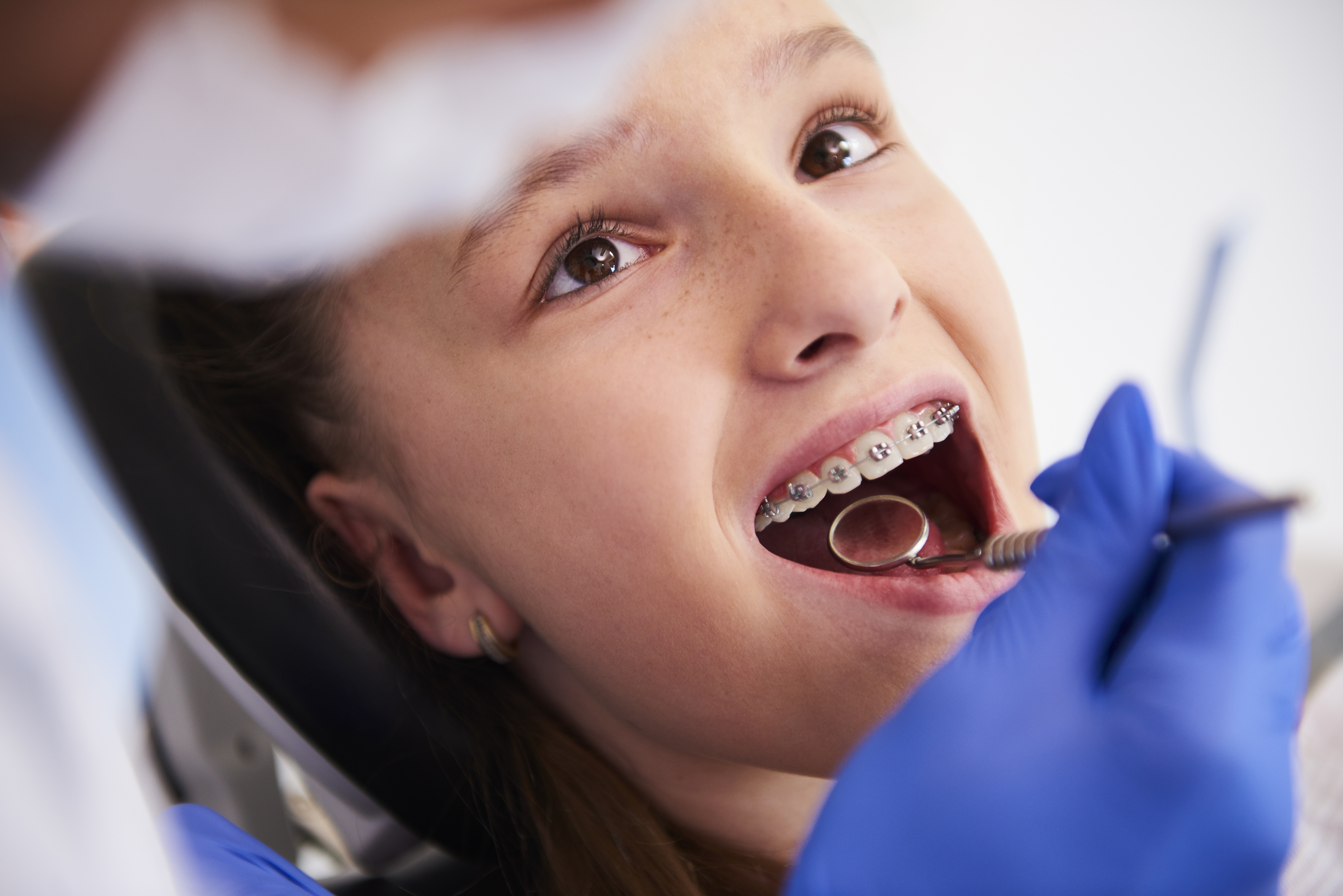 Orthodontic Treatment  Braces